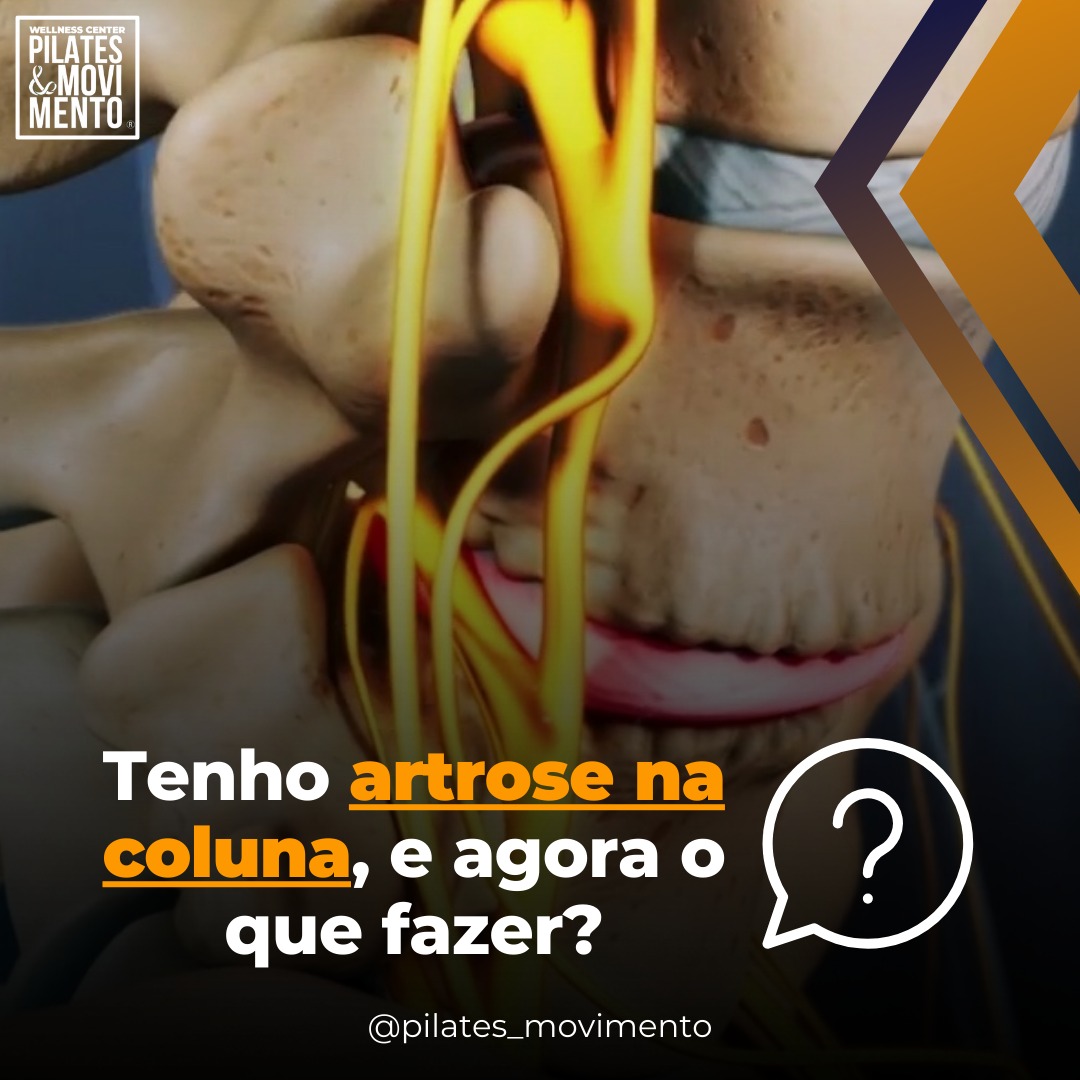 Tenho artrose na coluna, e agora o que fazer?