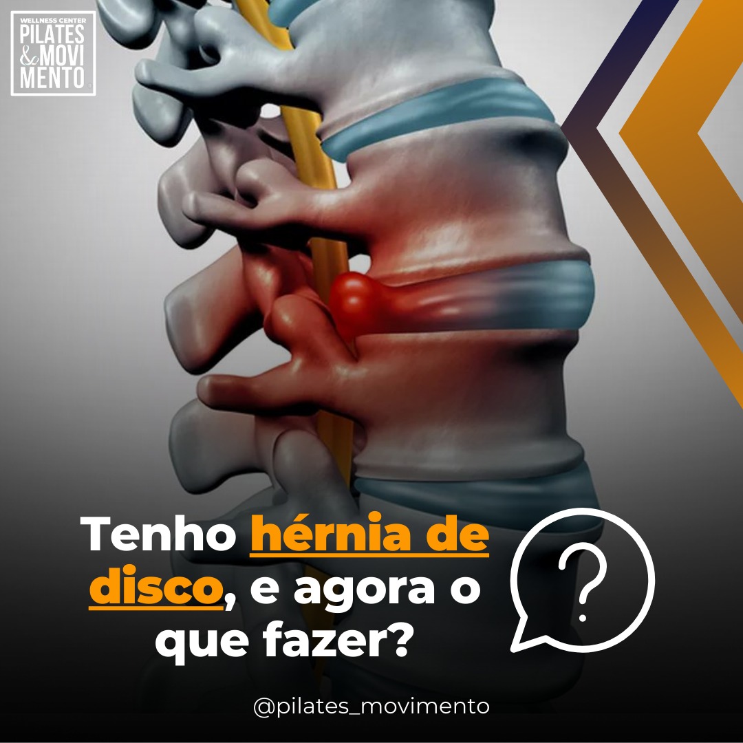 Tenho hérnia de disco, e agora o que fazer?